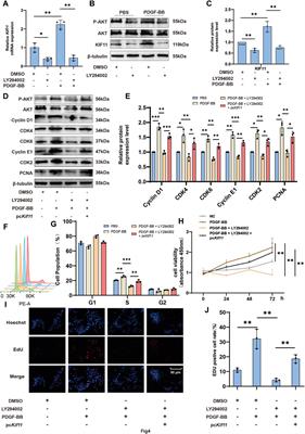 KIF11 promotes vascular smooth muscle cell proliferation by regulating cell cycle progression and accelerates neointimal formation after arterial injury in mice
